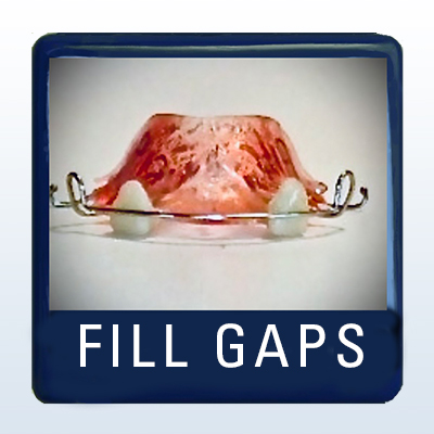 Fill Gaps
